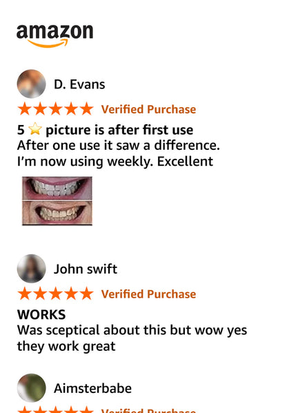 🟣 VIOLETTA™ V34 Whitening Strips