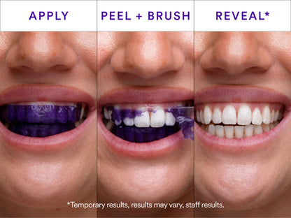 🟣 VIOLETTA™ V34 Whitening Strips